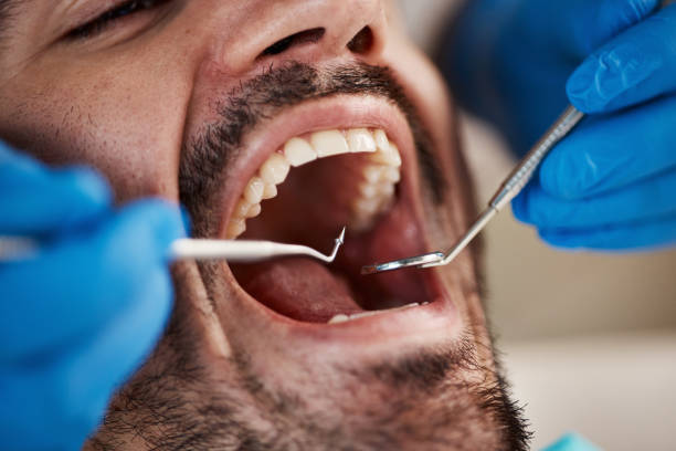Best Weekend Emergency Dental Services in Chanute, KS