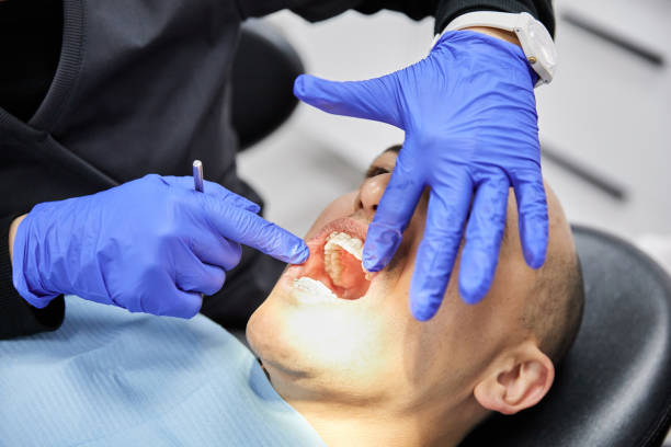 Best Knocked-Out Tooth (Avulsed Tooth) Treatment in Chanute, KS